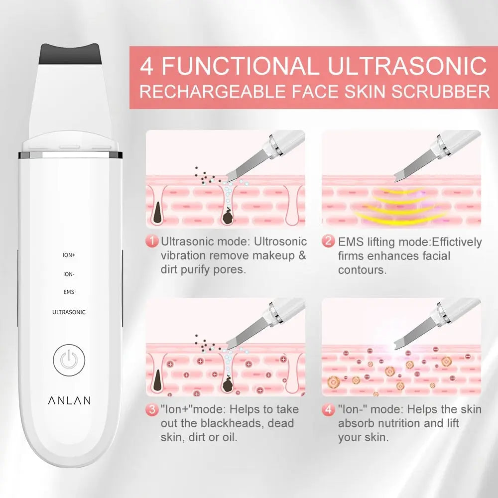 ANLAN Ultrasonic Ultraschallpeelinggerät Ionen Hautreiniger für Gesichtspflege Porenreiniger ANLAN Ultrasonic Ultraschallpeelinggerät Ionen Hautreiniger für Gesichtspflege Porenreiniger
